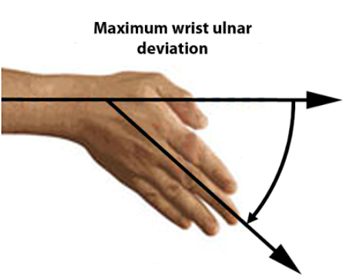 *Ulnar